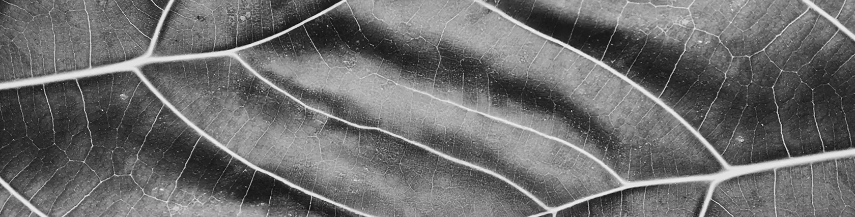 Flebología_TekdermaWellness_Varices